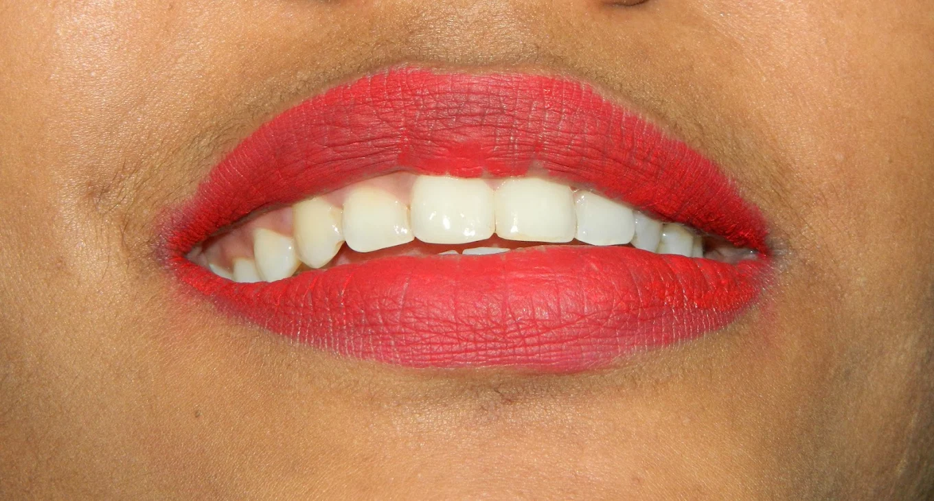 Dental Treatment